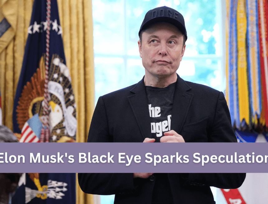elon-musks-black-eye-sparks-speculation-amid-drug-use-allegations Elon Musk